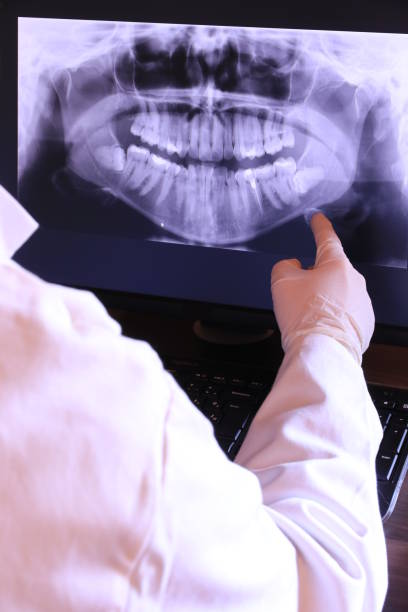 Best Emergency Root Canal Treatment in Rock Hall, MD