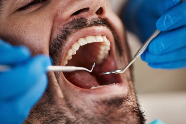 Best Urgent Dental Care for Toothache in Rock Hall, MD