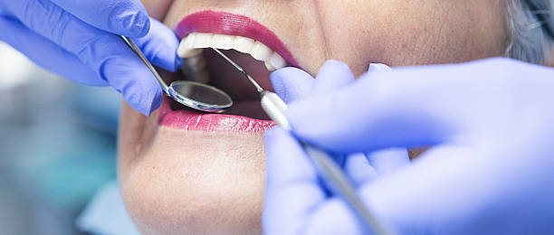 Best Holiday Emergency Dentist in Rock Hall, MD